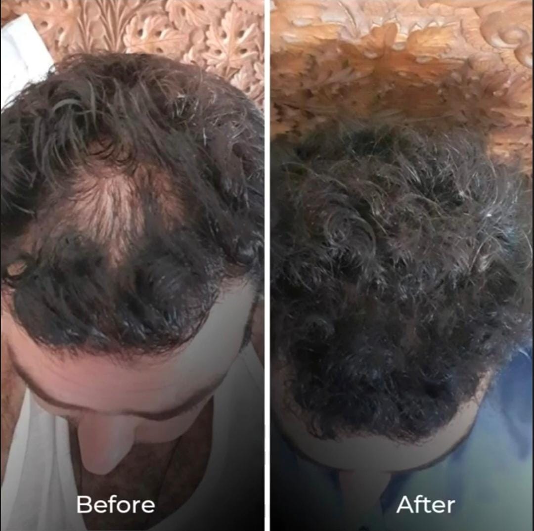 AuraShine Hair Food Oil