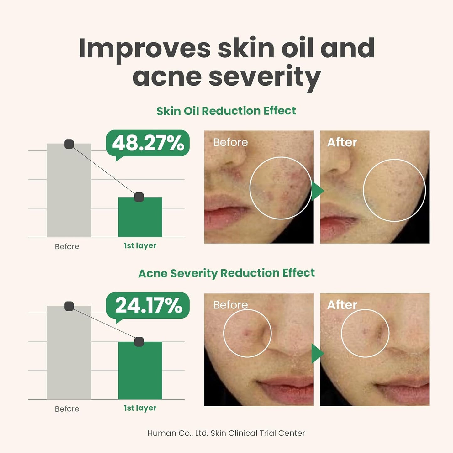 AXIS-Y Spot The Difference Blemish Treatment/15ml