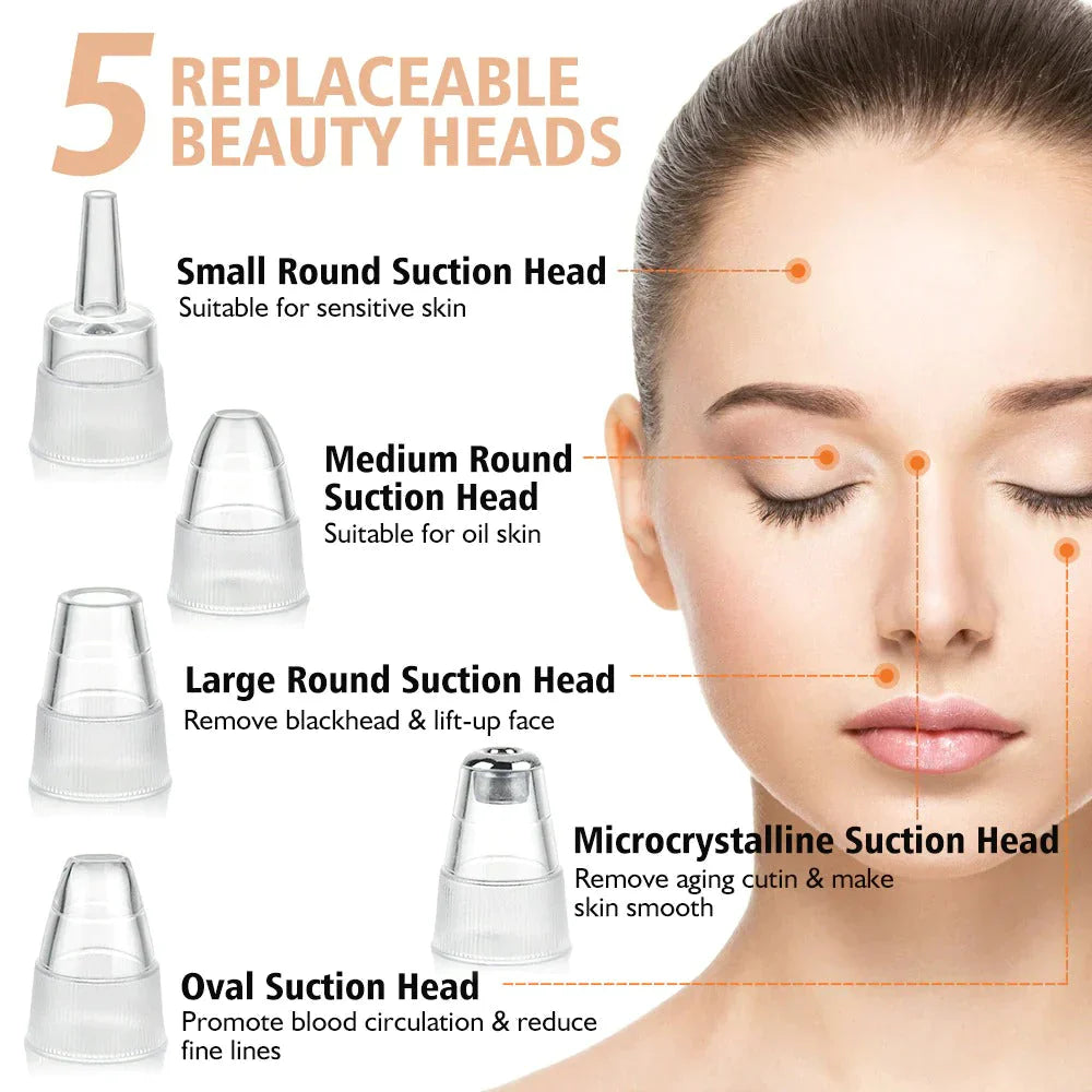 Rechargeable Blackhead Remover Vacuum Cleaner | mnshop.pk