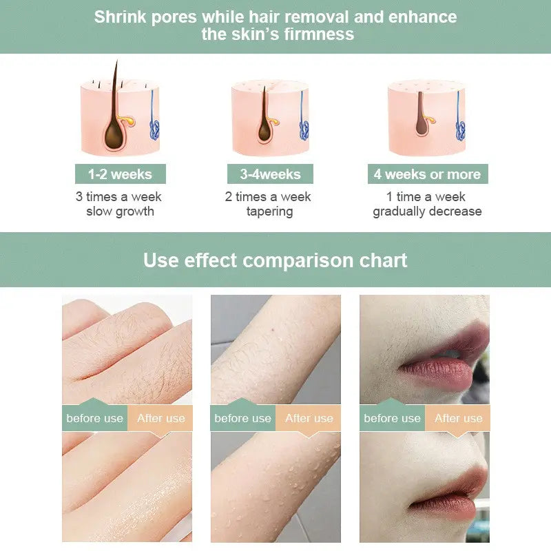 3 in 1 Ipl Laser Epilator Painless Ipl Hair Removal System Hair Remover for Hair Removal Home Use
