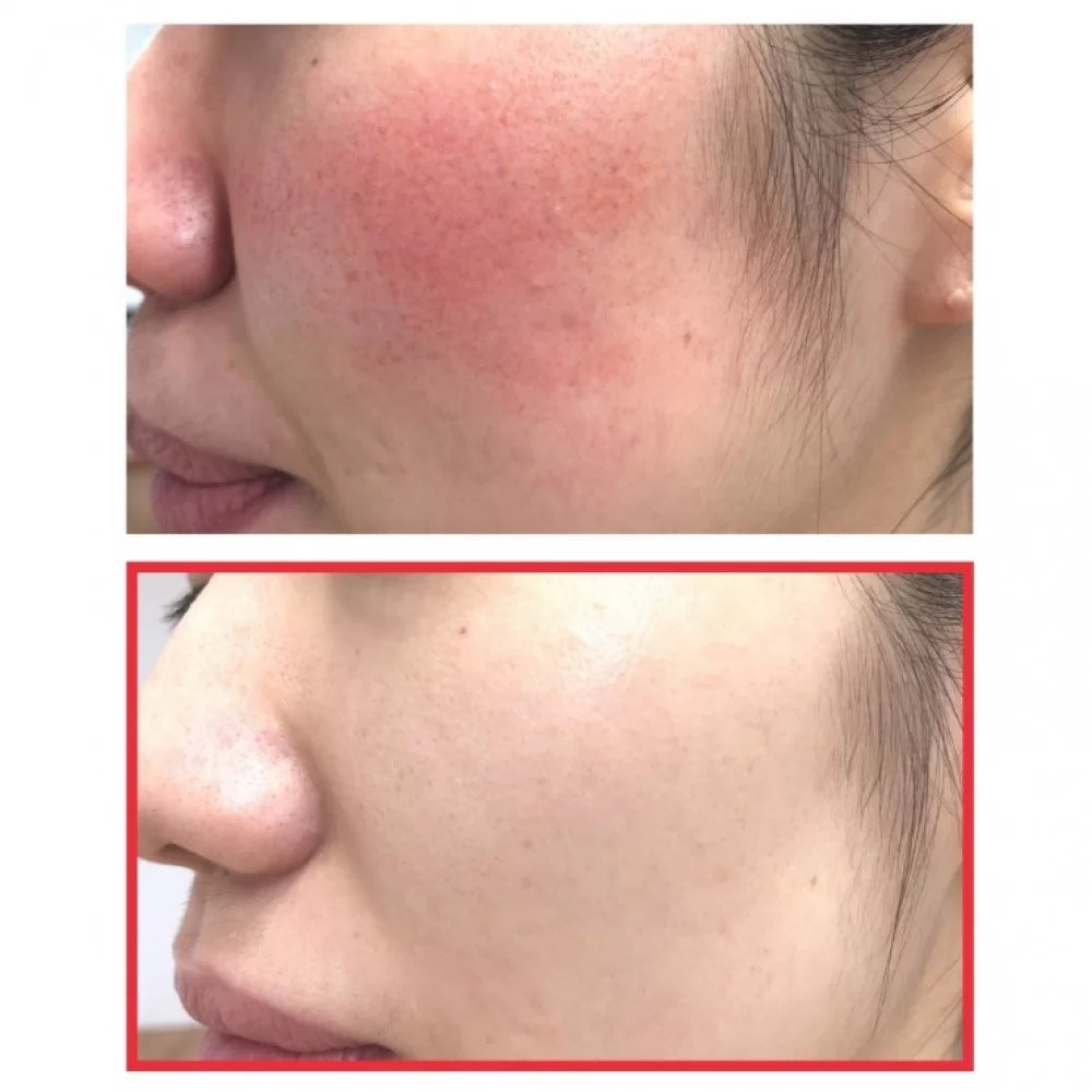 Some By Mi - Snail Truecica Miracle Repair Cream 60g