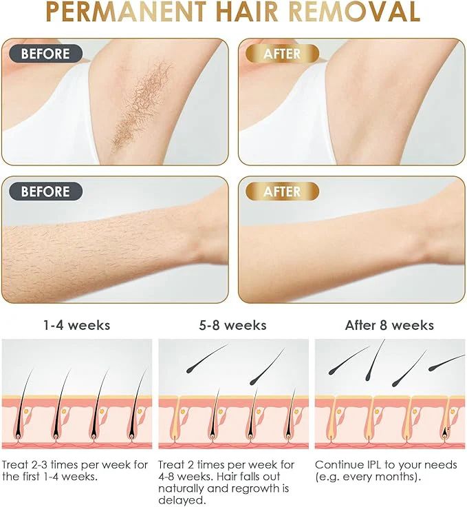 BabyVerse Professional IPL Laser Permanent Hair Removal