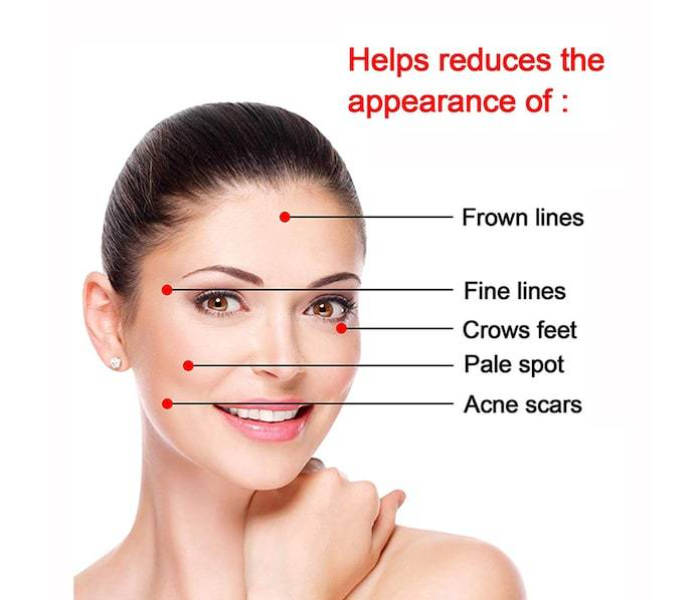 4 In 1 Derma Roller Micro-Needling Skin Care System