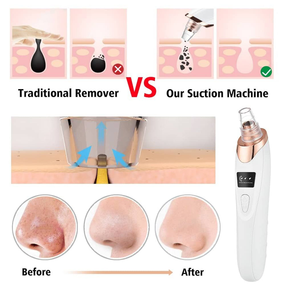 5 in 1 Rechargeable Blackhead Remover Derma Suction Machine