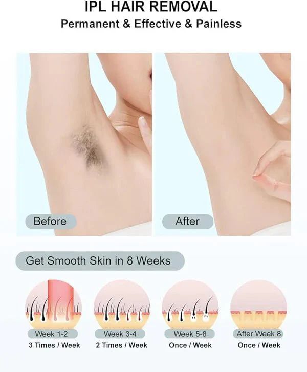 BabyVerse Professional IPL Laser Permanent Hair Removal