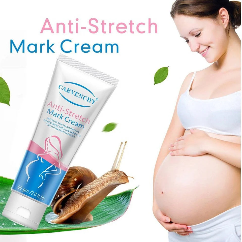 Aichun Beauty Anti-Stretch Mark Cream.