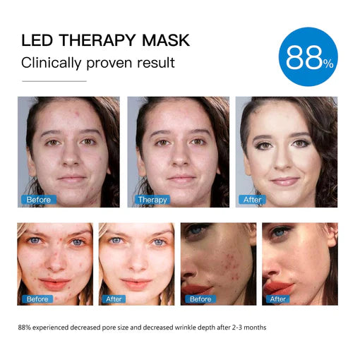 Professional LED Beauty Mask | Pores Tightening, Skin Repair & Whitening