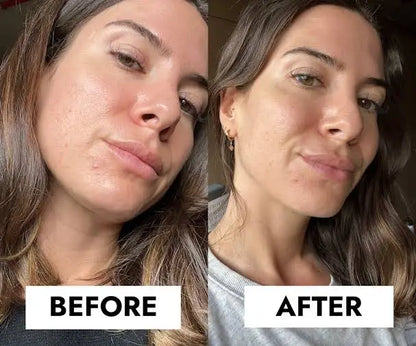 CeraVe Blemish Control Gel Moisturiser with 2% Salicylic Acid & Niacinamide for Blemish-Prone Skin 40ml
