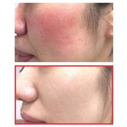Some By Mi - Snail Truecica Miracle Repair Cream 60g