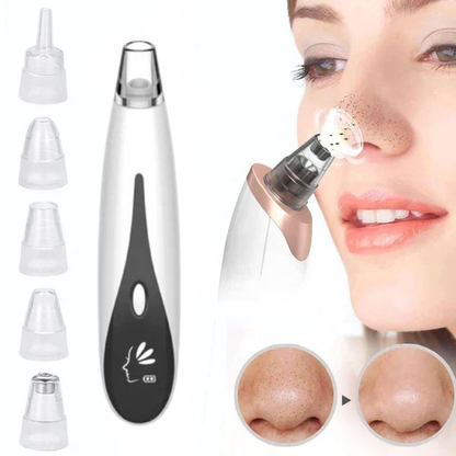 Rechargeable Blackhead Remover Vacuum Cleaner | mnshop.pk