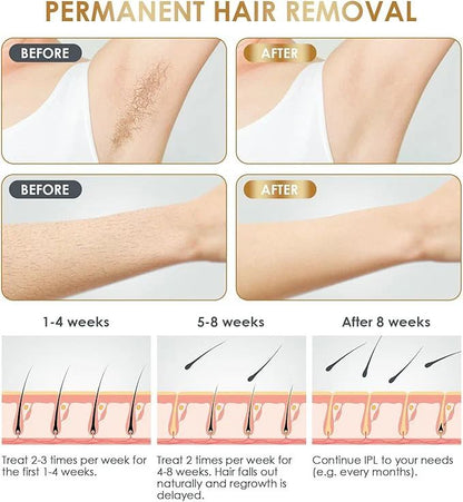 BabyVerse Professional IPL Laser Permanent Hair Removal