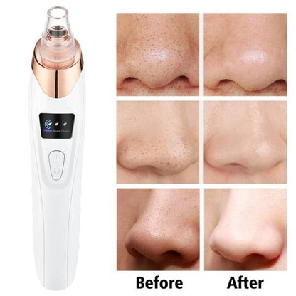 5 in 1 Rechargeable Blackhead Remover Derma Suction Machine