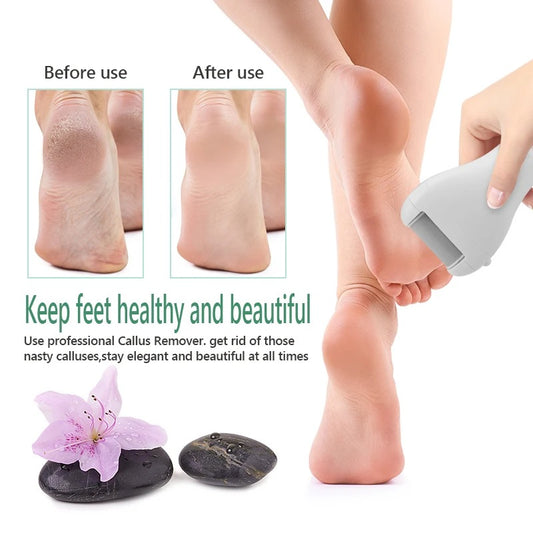 Electric Callus Remover For Feet Digital Usb Rechargeable