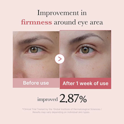 Medicube PDRN Pink Peptide Eye Cream 30ml