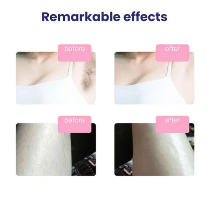 MNshop' IPL Hair Remover  SM-888